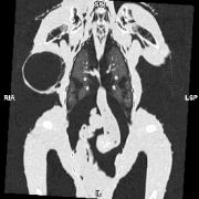 An x-ray of a bird