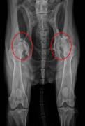 An x-ray showing hip dysplasia