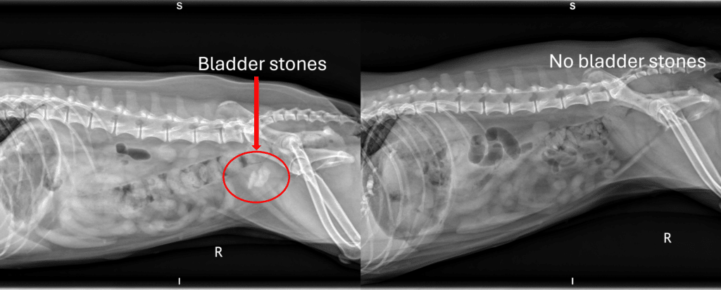 Pre- and post-bladder stones x-rays side by side