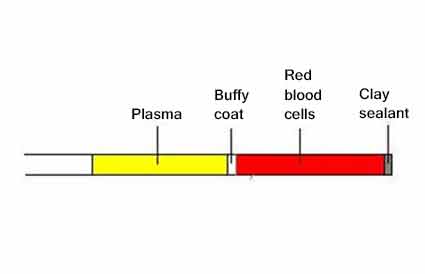 packed cell volume