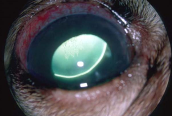 A close up image of glaucoma in an eye