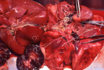 Heartworm (Dirofilaria immitis) exposed in internal organs of a dog during necropsy.
