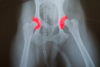 Xray of canine hip dysplasia