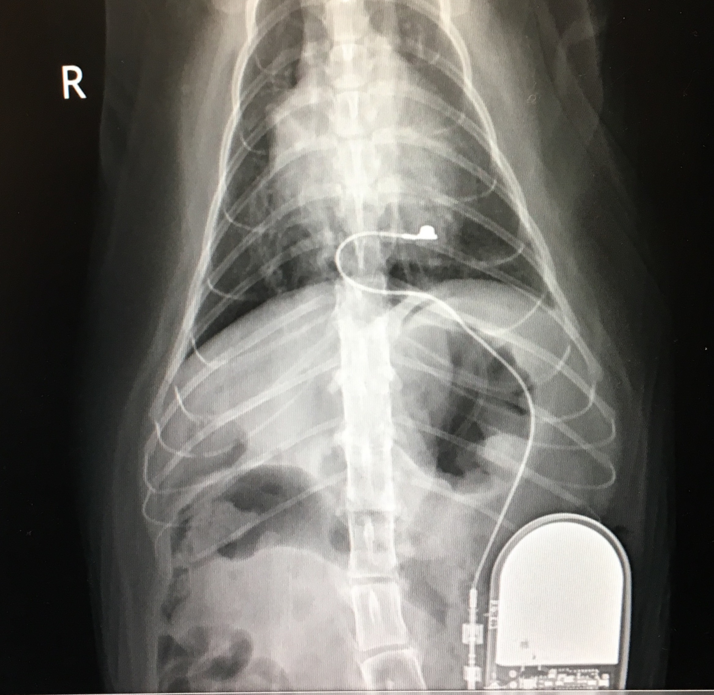 An x-ray of a pacemaker in a cat