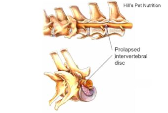 illustration of IVDD