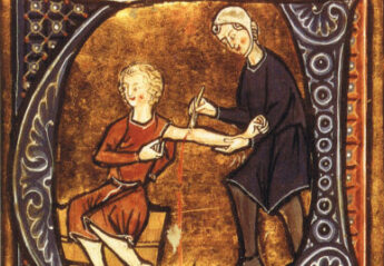 A historical illustration of bloodletting
