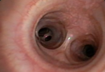 A bronchoscopy image of a dog's respiratory system