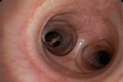 A bronchoscopy image of a dog's respiratory system