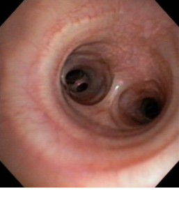 A bronchoscopy image of a dog's respiratory system