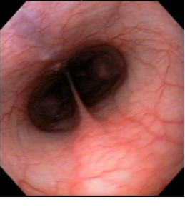 A bronchoscopy image of a dog's respiratory system