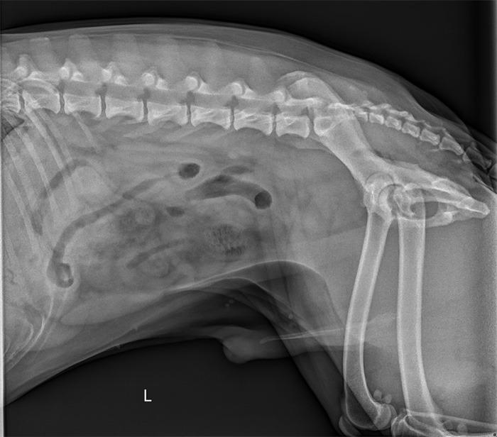 X-ray showing a corn cob in the intestines