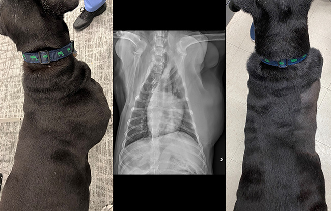 Hudson before and after surgery with x-ray of lipoma