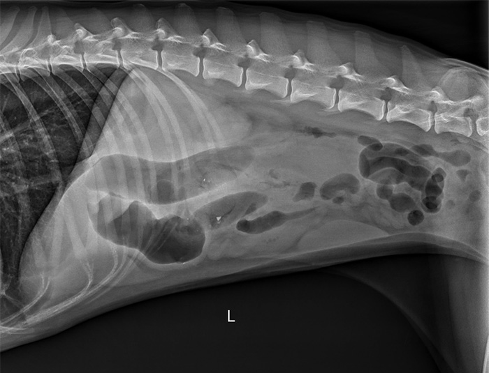 X-ray shows black ovoid areas in the intestines