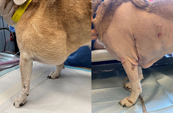 Snoopy lipoma pre- and post-op photos 
