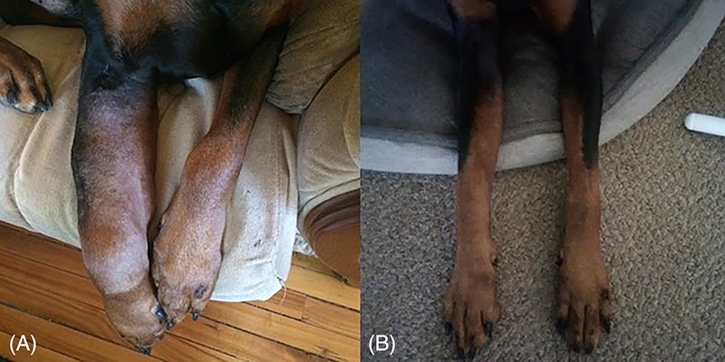 Before and after the correction of the arteriovenous anomaly