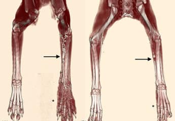 colorized CT angiogram