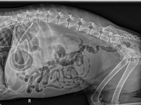 NG tube shown in x-ray