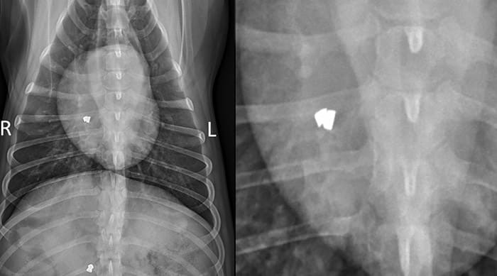 X-ray with bullet in heart