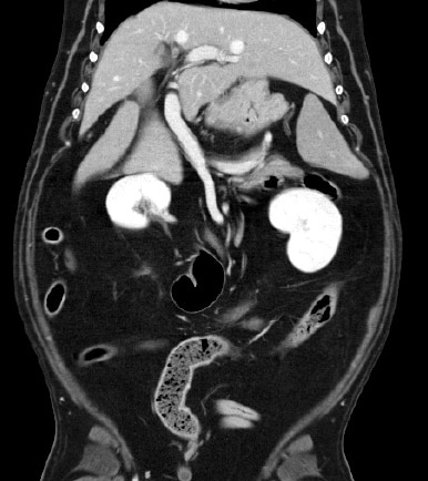 CT scan of a dog's abdomen with intravenous dye