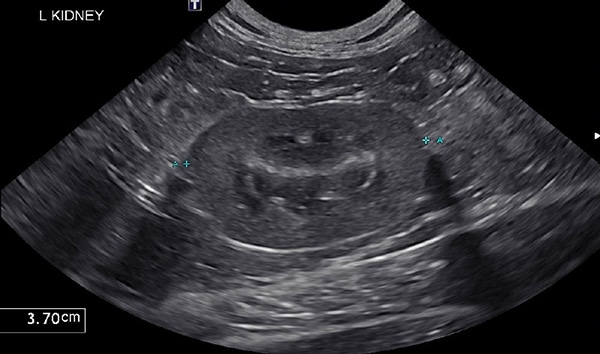 Ultrasound of a cat's kidney