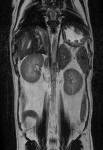 MRI of a dog's abdomen