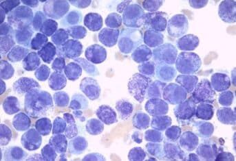 Microscope image of mast cell tumor cells.
